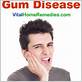 fasting gets rid of gum disease