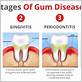 first stages of gum disease