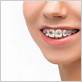 fix jaw alignment from gum disease
