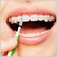 floss dental coppell reviews