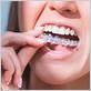 floss dental invisalign cost