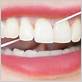 flossing causes gum disease