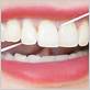 flossing teeth gum disease