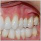 geneva gum disease treatments