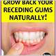 get rid of gum disease naturally