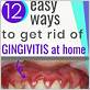 getting rid of gingivitis at home