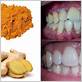 ginger paste for gum disease