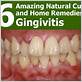 gingivitis natural remedies