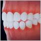 greg campbell gum disease ca