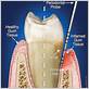 gum and bone disease treatment