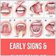 gum diseas signs in throat