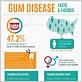 gum disease advice