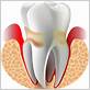 gum disease alexandria virginia