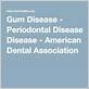 gum disease american dental association
