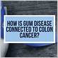 gum disease and bowel cancer