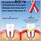 gum disease and health issues