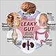 gum disease and leaky gut