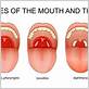 gum disease and recurring sore throats