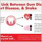 gum disease and stroke fake