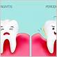 gum disease and symptoms
