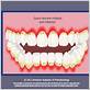 gum disease animation