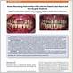 gum disease article