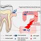 gum disease bacteria and alzheimer's