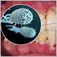 gum disease bacteria found in alzheimer& 39