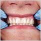 gum disease bad taste in mouth