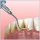 gum disease beaverton or