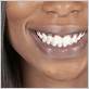 gum disease black people