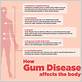 gum disease body affects