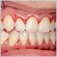 gum disease burgaw nc