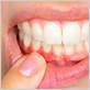 gum disease cancer symptoms