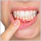 gum disease canton mi