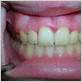 gum disease chatham nj