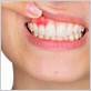 gum disease chiswick