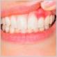 gum disease clear lake tx
