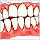 gum disease clipart