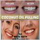 gum disease coconut oil pulling