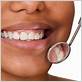 gum disease columbia md