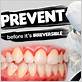 gum disease combating