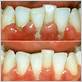 gum disease cosmetic dentistry