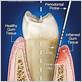 gum disease cypress tx