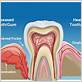 gum disease dallas