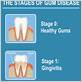 gum disease dental codes