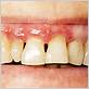gum disease dentist beverly hills