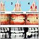 gum disease dentist brantford