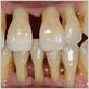 gum disease dentist cleveland solon