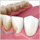 gum disease dentist kent wa